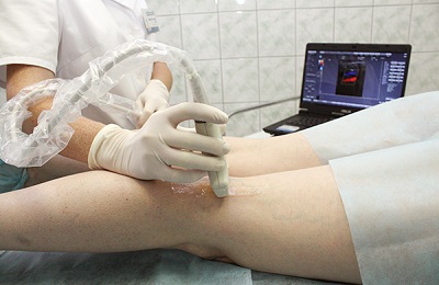 Обследование ног