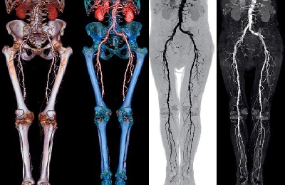 Обследование ног