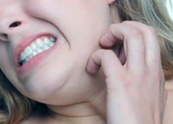 Аллергическая реакция