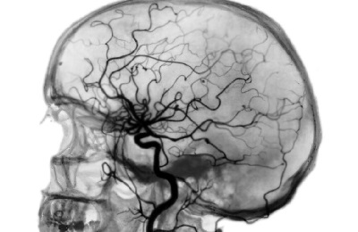 Человеческий мозг