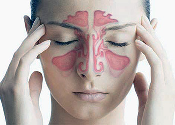 Развитие гайморита