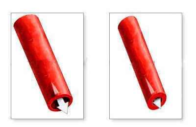 Сужение сосуда