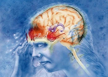 Мигрень с аурой