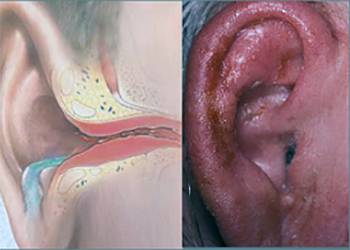 Факторы атита