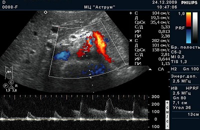 Обследование сосуда