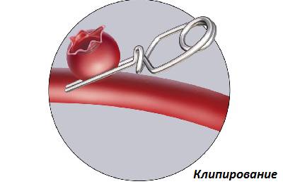 Клипирование