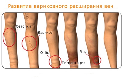 Поражение ног