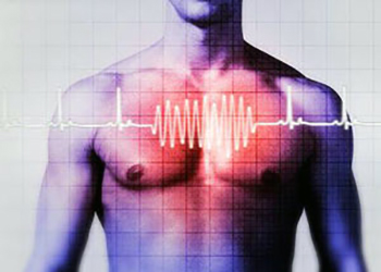 Проявление тахикардии 