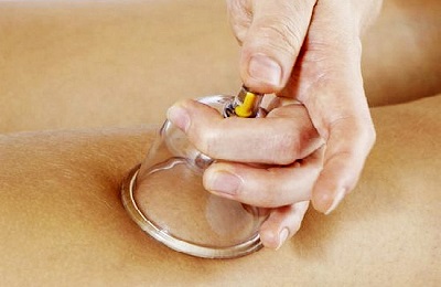 Вакуумный массаж