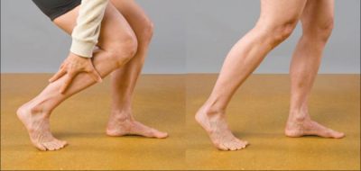 Больно ходить