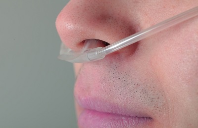 Посинение губ