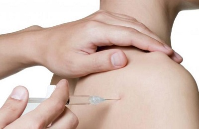 пролотерапия