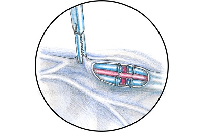 Операция Паломо