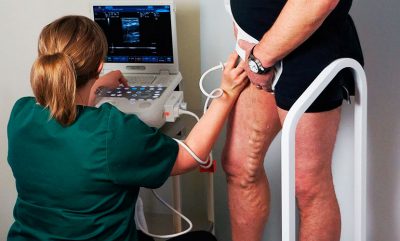 Сканирование вен