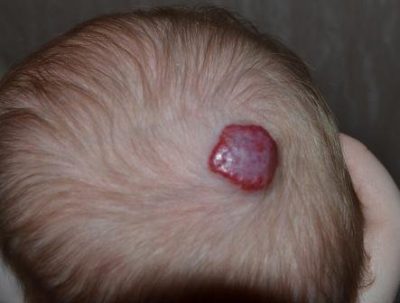 Патология на голове