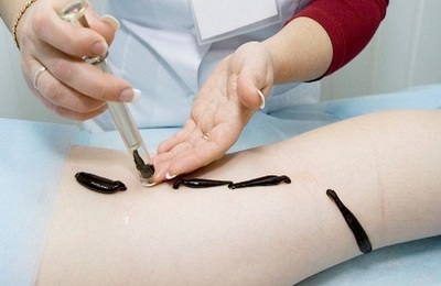 Применение в медицине