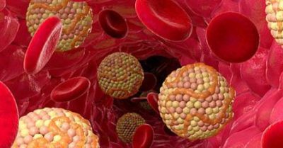 Холестерин в крови