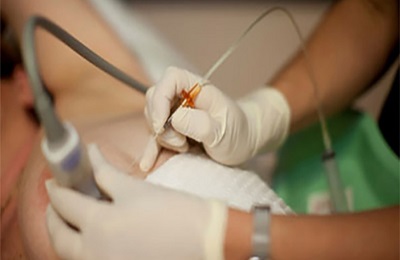 Проведение операции