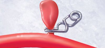 Зажим сосуда