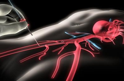 Обследование сердца