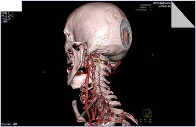 Обследование головы