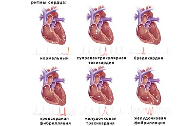 Сердечные ритмы
