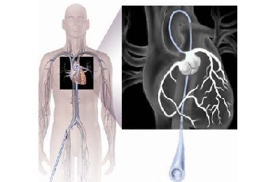 Как происходит