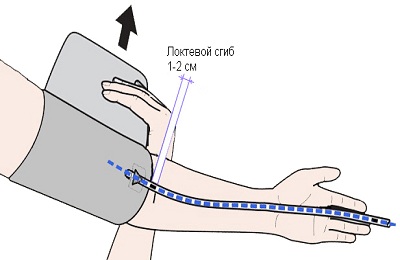 Проба жгута