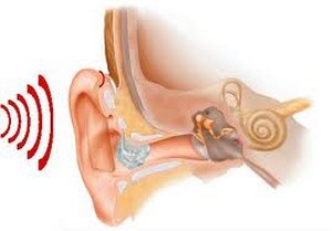 Нарушение слухового восприятия