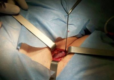 Операция на ноге