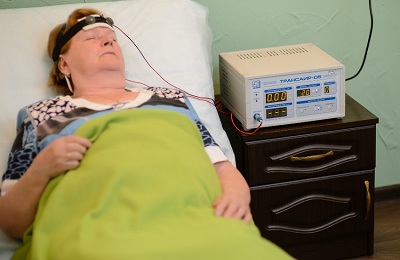 Транскраниальная электростимуляция