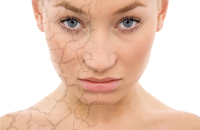 Пиллинг лица