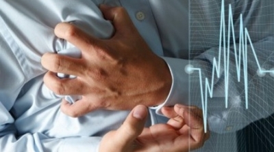 Тахикардия