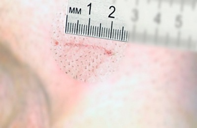 Операция Мармара