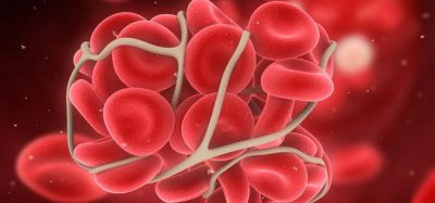 Формирование тромба