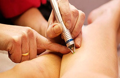 Электрокоагуляция