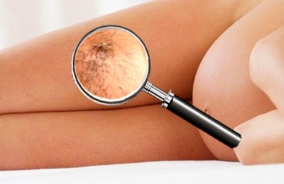 Поражение ног