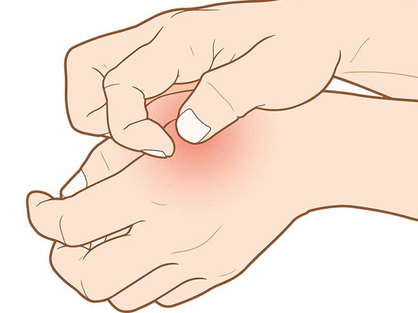 Сыпь на руке