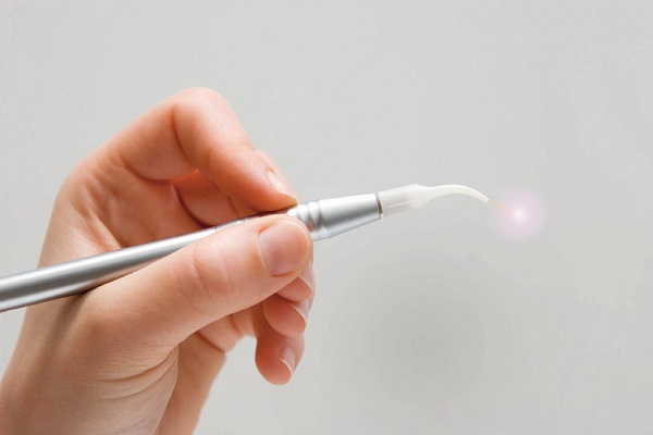 Лазерное лечение угревой болезни