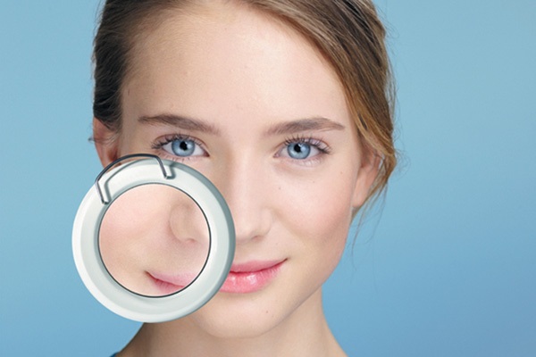 Акне у девушки в подростковом возрасте