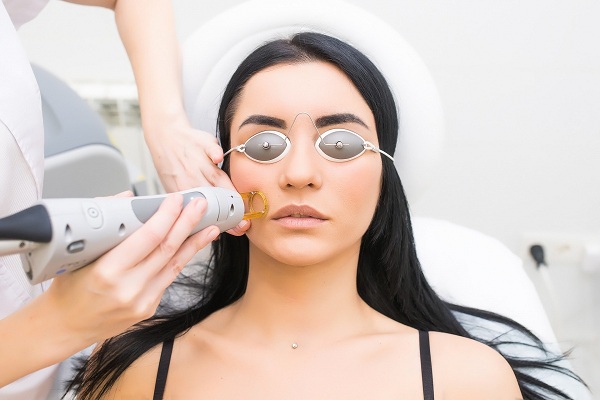 Лазерное лечение акне у красивой девушки