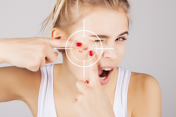 Девушка, лечащая акне