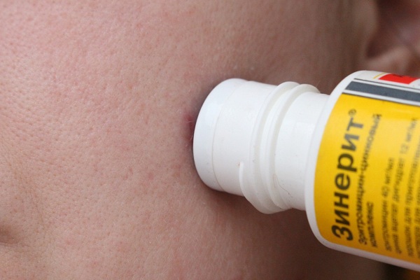 Применение Зинерита