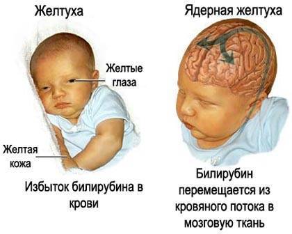 На белках глаз красные прожилки