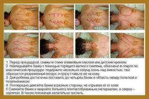 Как правильно делать массаж при воспалении легких