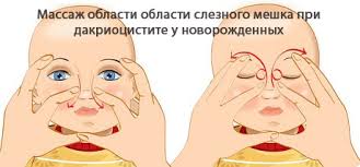 Слезятся и гноятся глаза у взрослого что делать