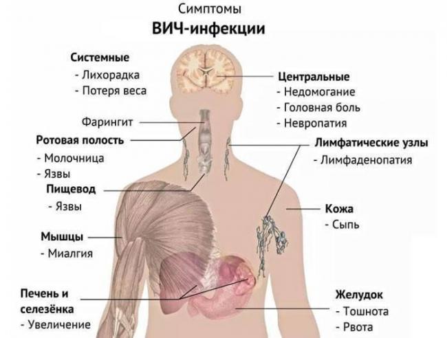 Симптомы туберкулеза легких на ранней стадии у взрослых и детей