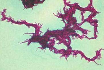 Микобактерии туберкулеза -mycobacterium tuberculosis