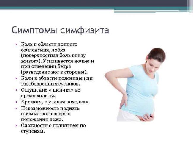 Проблемы с симфизом при беременности: можно ли рожать самой?