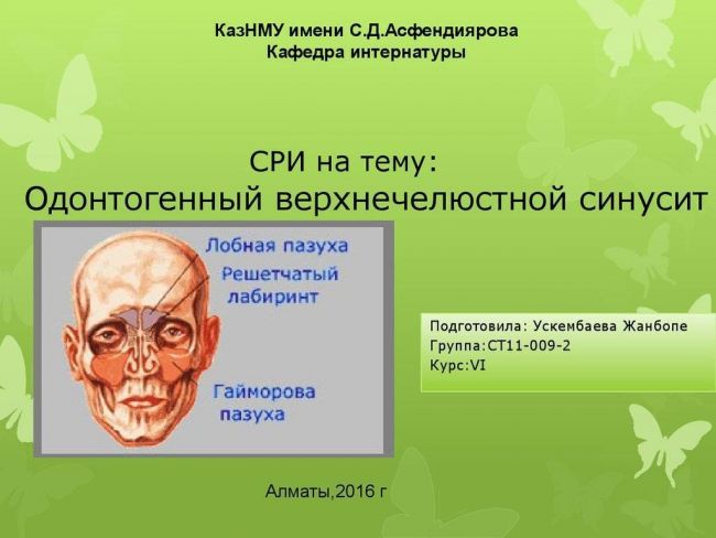 Что нужно знать об одонтогенном синусите?